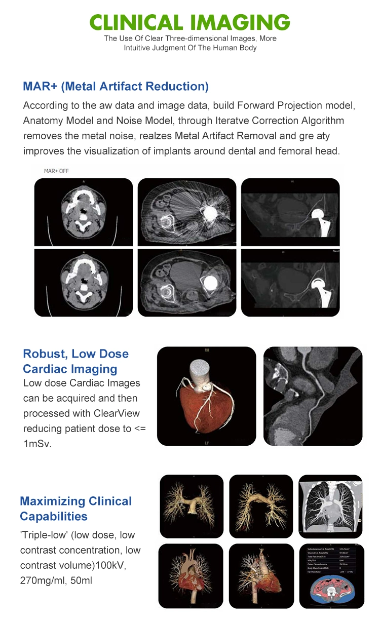 CT Scan Machine Scanner Medical MRI Pet 4 16 32 64 128 Slice System Sinovision Portable for Sale Mobile Dr Computed Tomography